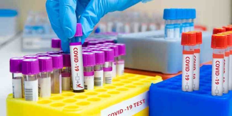 Salud Pública informa 4,936 casos activos de coronavirus en el país